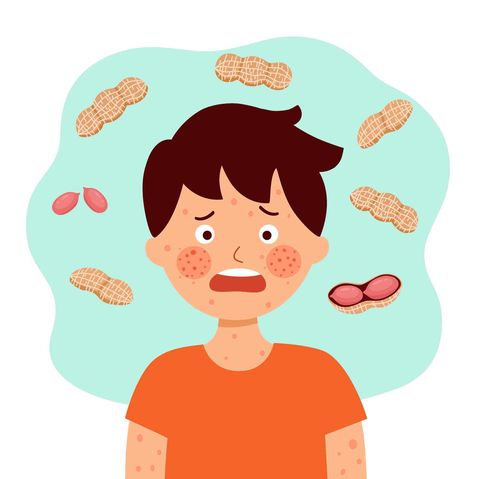Cartoon of a boy allergic to peanuts